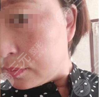 北京火箭軍總醫(yī)院激光整形美容中心