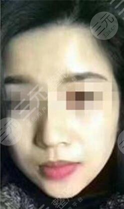 北京空軍總醫(yī)院激光整形美容中心