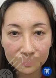 北京亞奧整形美容診所