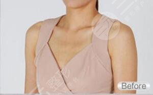 北京榮軍醫(yī)院激光美容中心