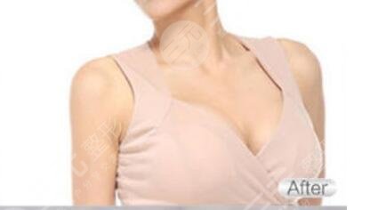 北京榮軍醫(yī)院激光美容中心