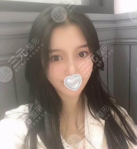 火鳳凰溶脂有果嗎