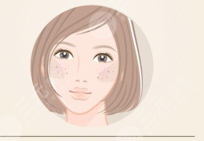 激光祛黃褐斑反多久可以恢復