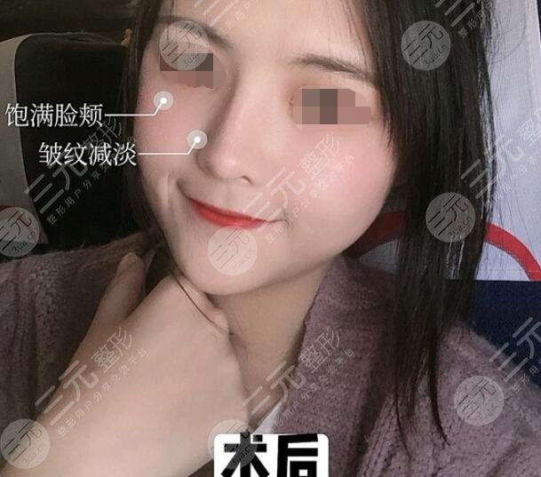 徐懷河醫(yī)生真人案例參考后