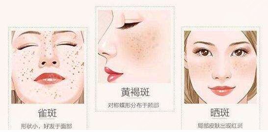 彩光去雀斑的注意事項(xiàng)