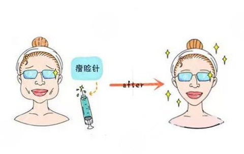 注射瘦臉注射