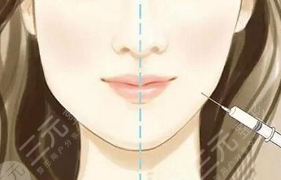 注射瘦臉
