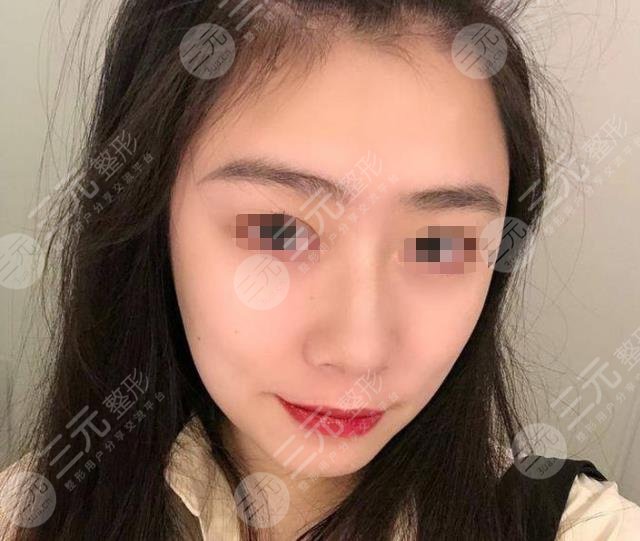 上海九院熱瑪吉過程分享