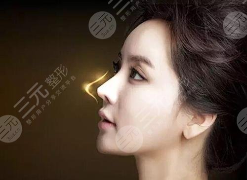 鼻翼縮小修復(fù)