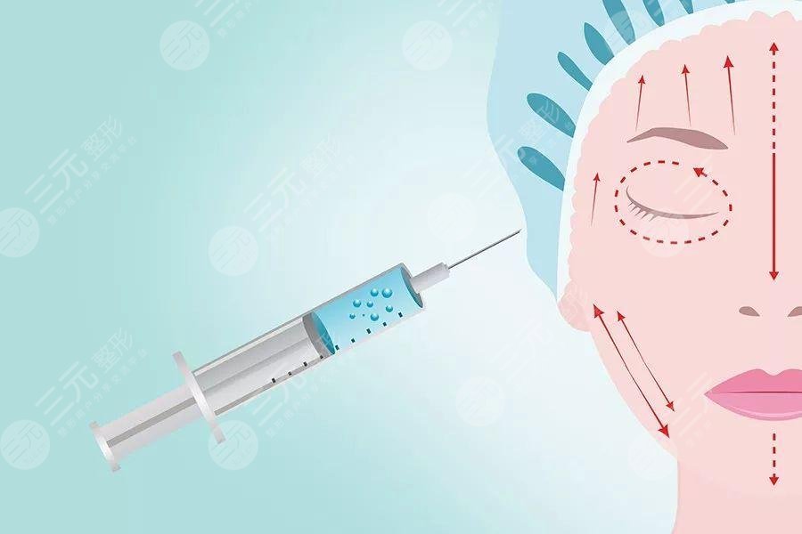怎么去除額頭皺紋