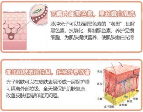 光子嫩膚的原理
