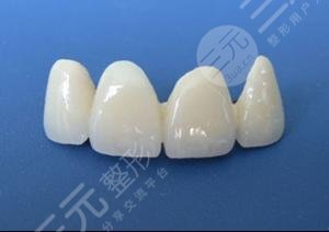 如何防止牙齒松動(dòng)