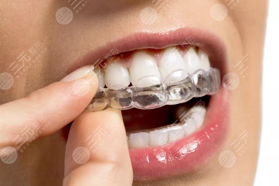 5類人不能做牙齒整形