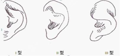 杯狀耳矯正多少錢(qián)