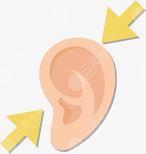 杯狀耳矯正多少錢(qián)