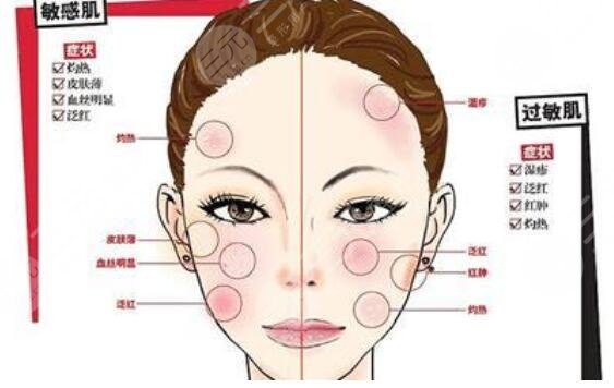 敏感肌做熱瑪吉痛嗎