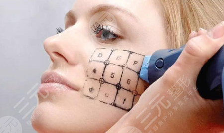 熱瑪吉可以去皺紋嗎