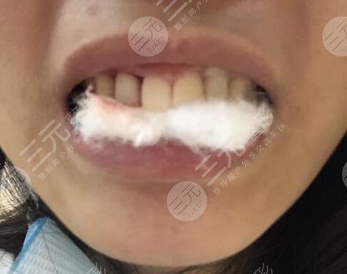 六安高峰口腔價格表