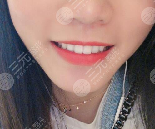 六安高峰口腔價格表