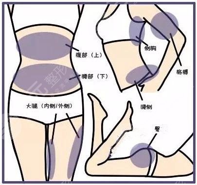 冷凍溶脂減肥靠譜嗎