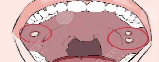 牙齒矯正注意事項