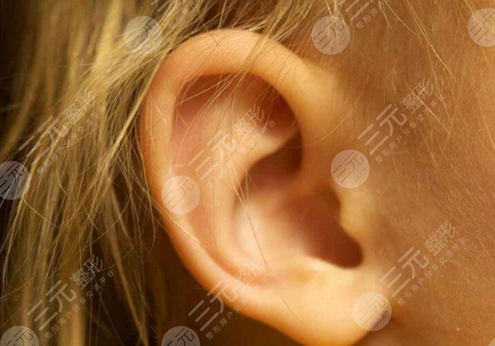 耳缺失再造手術(shù)技術(shù)成熟嗎？做手術(shù)有哪些注意事項？快來學(xué)習(xí)！