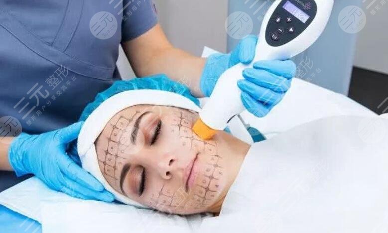 先做超聲提拉還是先做熱瑪吉比較好？專業(yè)人士告訴你怎么選！