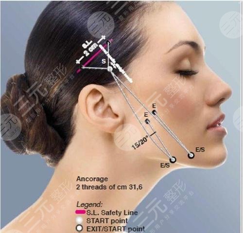 提升抗皺的副作用有哪些?