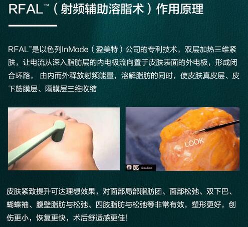 鉆石吸脂瘦臉怎么樣