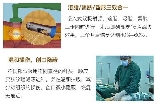 鉆石吸脂瘦臉怎么樣