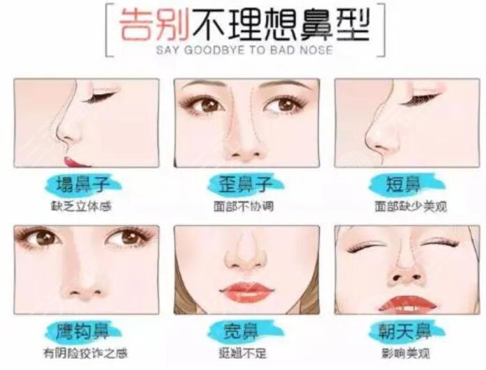 修復隆鼻需要多少錢