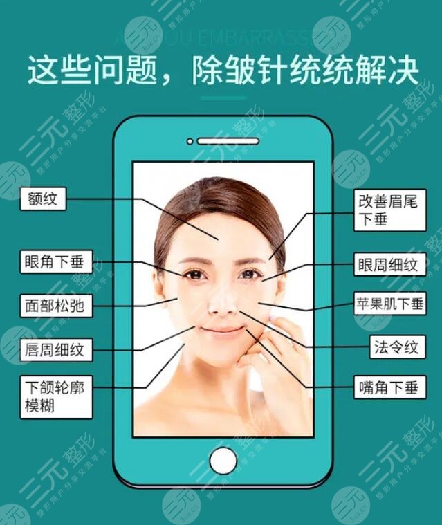 注射注射除皺有啥注