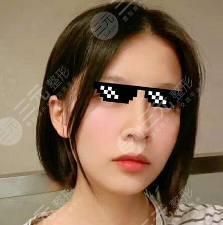 7d聚拉提體驗果圖