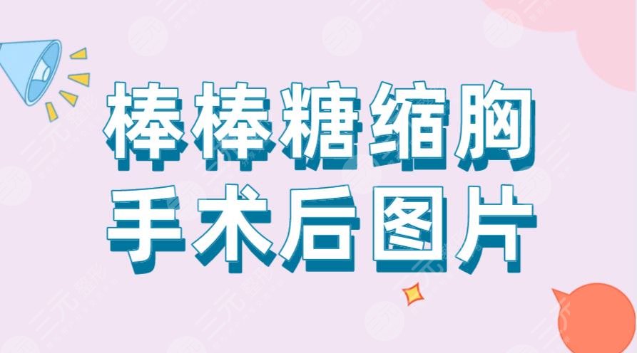 棒棒糖縮胸手術(shù)后圖片！手術(shù)過程是怎樣的？風(fēng)險(xiǎn)大嗎？附價(jià)格表