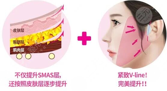 激光除皺術(shù)是什么原理