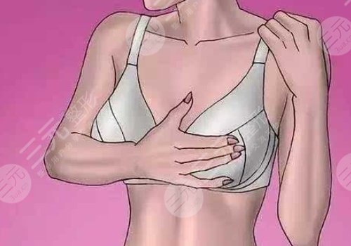 傲諾拉隆胸的果