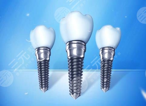 種植牙適合多大年齡的人