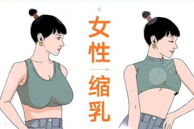 乳房縮小棒棒糖手術術前需要準備哪些工作?