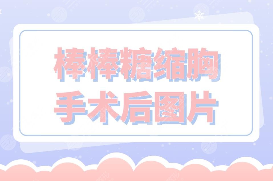 棒棒糖縮胸手術(shù)后圖片分享！附手術(shù)原理介紹+手術(shù)注意事項(xiàng)