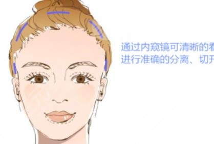 迷你小拉皮多少錢