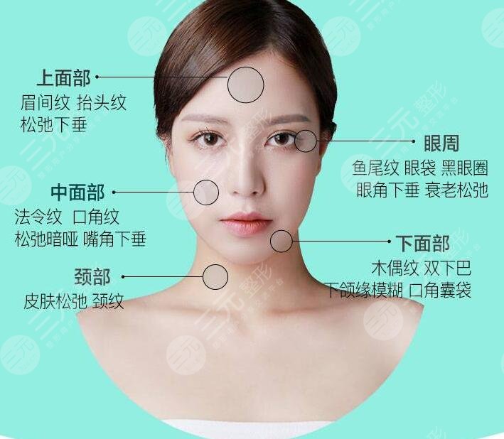 內(nèi)窺鏡拉皮