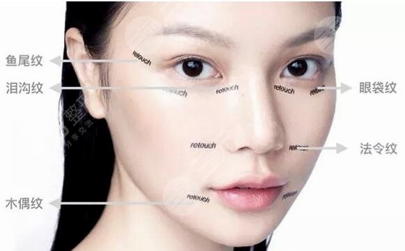 迷你小拉皮除皺手術(shù)降低風(fēng)險嗎