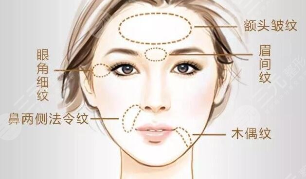 拉皮除皺時候有什么副作用呢