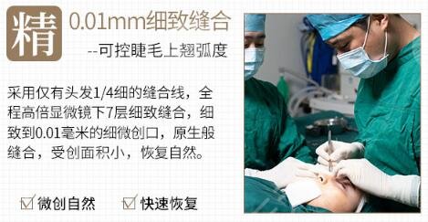 祁佐良教授 技術(shù)