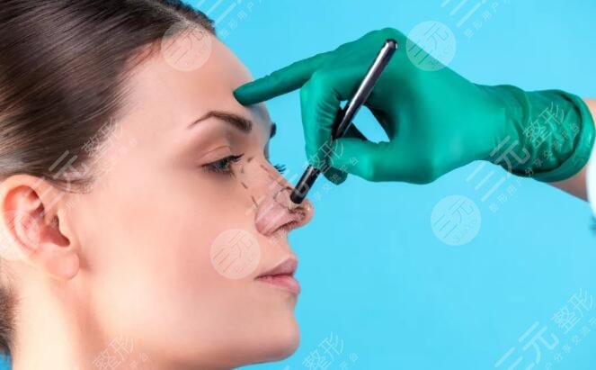 隆鼻假體壽命有多長(zhǎng)？假體隆鼻能夠維持多長(zhǎng)時(shí)間？假體隆鼻注意事項(xiàng)