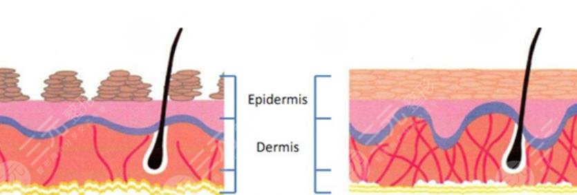 5d膠原光做一次多少錢(qián)