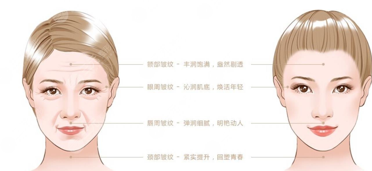 應(yīng)用范圍的不同