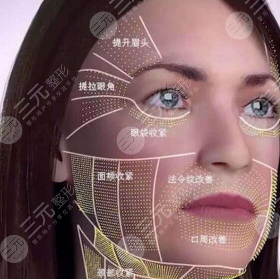 如何延長3D射頻美容手術(shù)的維持時間