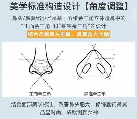 鼻翼縮小手術(shù)費(fèi)用大概是多少錢，降低風(fēng)險(xiǎn)嗎？價(jià)格參考&術(shù)后護(hù)理指南！