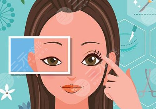 10個開內(nèi)眼角9個留疤怎么辦？怎么避免開眼角留疤？注意事項帶你了解！